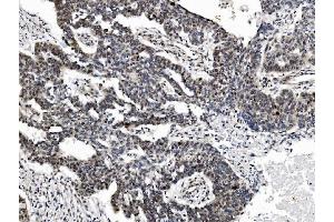 IHC analysis of PRDM14 using anti-PRDM14 antibody (ABIN7603152).