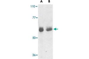 Western blot analysis of TRAF3IP2 expression in human lung (lane A) and placenta (lane B) tissue lysates with TRAF3IP2 polyclonal antibody  at 1 ug /mL . (TRAF3IP2 anticorps  (AA 2-15))