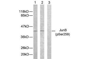Western blot analysis of extracts from HeLa cells using JunB (phospho-Ser259) antibody (E011027). (JunB anticorps  (pSer259))