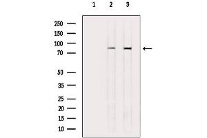 anti-Fibroblast Growth Factor Receptor 3 (FGFR3) (C-Term) antibody