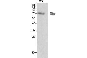Western Blot (WB) analysis of specific cells using Midline-1 Polyclonal Antibody.