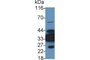 Detection of LDHB in Rat Heart lysate using Polyclonal Antibody to Lactate Dehydrogenase B (LDHB)