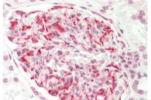 Rabbit Anti-EIF6 antibody Catalog Number: ARP61387 Formalin Fixed Paraffin Embedded Tissue: Human Kidney Primary antibody Concentration: 1:100 Secondary Antibody: Donkey anti-Rabbit-Cy3 Secondary Antibody Concentration: 1:200 Magnification: 20x Exposure Time: 0. (EIF6 anticorps  (C-Term))