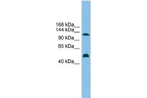 WB Suggested Anti-GART Antibody Titration: 0. (GART anticorps  (Middle Region))