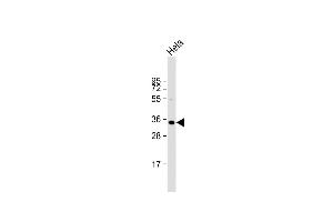 Anti-ARV1 Antibody (N-term) at 1:2000 dilution + Hela whole cell lysate Lysates/proteins at 20 μg per lane.
