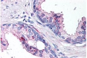 Prostate (IL-24 anticorps  (AA 100-150))