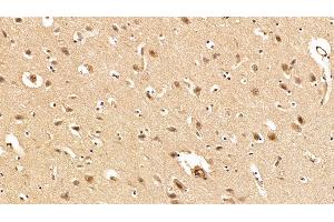 Detection of TDP43 in Porcine Cerebrum Tissue using Polyclonal Antibody to Tar DNA Binding Protein 43 kDa (TDP43)