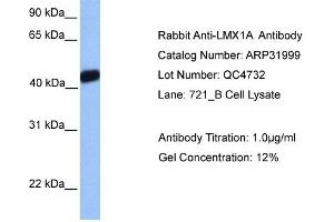 Western Blotting (WB) image for anti-LIM Homeobox Transcription Factor 1, alpha (LMX1A) (Middle Region) antibody (ABIN182469) (LMX1A anticorps  (Middle Region))