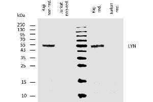 Western blotting analysis of human LYN using mouse monoclonal antibody LYN-01 on lysates of Raji cell line and Jurkat cell line (LYN non-expressing cell line, negative control) under non-reducing and reducing conditions. (LYN anticorps  (AA 8-238))