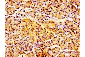 Immunohistochemistry of paraffin-embedded human pancreatic tissue using ABIN7156829 at dilution of 1:100 (IL18R1 anticorps  (AA 22-128))