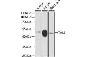 Western blot analysis of extracts of various cell lines, using T antibody (ABIN6132557, ABIN6148834, ABIN6148835 and ABIN6216741) at 1:3000 dilution. (TAL1 anticorps  (AA 242-331))