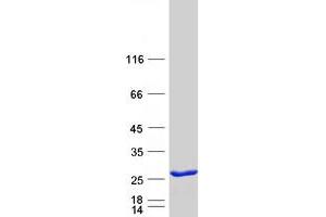 Validation with Western Blot