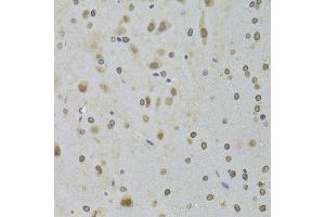 Immunohistochemistry of paraffin-embedded rat brain using DDX1 Antibody (ABIN5973950) at dilution of 1/100 (40x lens). (DDX1 anticorps)