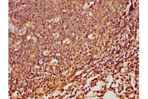 IHC image of ABIN7168929 diluted at 1:100 and staining in paraffin-embedded human tonsil tissue performed on a Leica BondTM system.