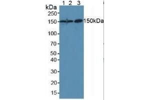Detection antibody from the kit in WB with Positive Control:  Sample Lane1: Mouse Placenta Tissue; Lane2: Mouse Liver Tissue; Lane3: Human Hela Cells. (CEA Kit ELISA)
