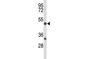 Western blot analysis of MEF2A antibody and mouse brain tissue lysate