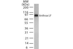 Image no. 1 for anti-Anthrax Toxin Lethal Factor (Lef) (AA 779-792) antibody (ABIN200035) (Anthrax Toxin Lethal Factor anticorps  (AA 779-792))