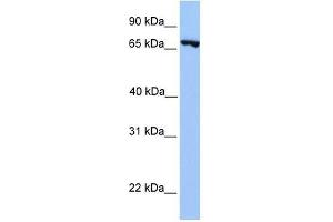 PRDM6 antibody used at 0. (PRDM6 anticorps  (N-Term))