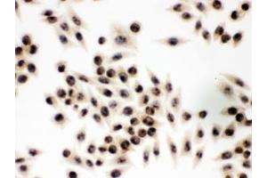 IHC testing of FFPE human SMMC-7221 cells with EIF3A antibody. (EIF6 anticorps  (AA 66-210))