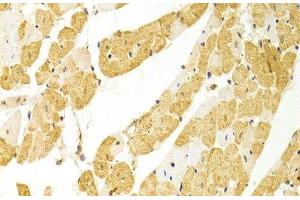 Immunohistochemistry of paraffin-embedded Rat heart using PLCB1 Polyclonal Antibody at dilution of 1:100 (40x lens). (Phospholipase C beta 1 anticorps)
