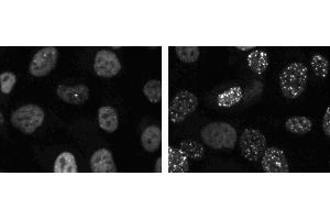 Immunofluorescent staining of HT1080 cells (ATCC CCL-121). (TP53BP1 anticorps  (AA 149-259))