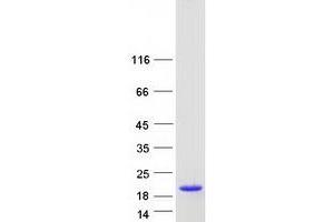 Retinol Binding Protein 2, Cellular (RBP2) protein (Myc-DYKDDDDK Tag)
