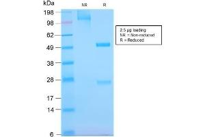 SDS-PAGE Analysis Purified EGFR-Monospecific Recombinant Rabbit Monoclonal Antibody (GFR/2968R).