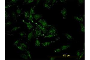 Immunofluorescence of monoclonal antibody to CFL2 on HeLa cell.