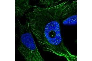 Immunofluorescent staining of human cell line U-2 OS with FGD4 polyclonal antibody  at 1-4 ug/mL dilution shows positivity in cytoskeleton (actin filaments). (FGD4 anticorps)