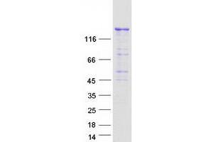 Validation with Western Blot