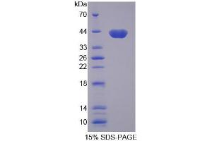 SDS-PAGE analysis of Human AQP8 Protein. (Aquaporin 8 Protein (AQP8))