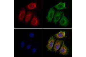 ABIN6259147 and ABIN6274943 staining Hela cells by IF/ICC. (PDE4C anticorps  (Internal Region))