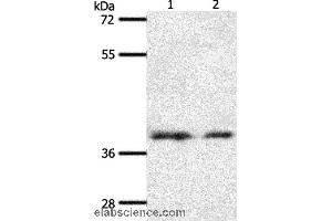 Western blot analysis of 293T and hela cell, using SSTR1 Polyclonal Antibody at dilution of 1:500 (SSTR1 anticorps)