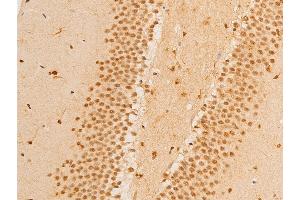 ABIN6267237 at 1/100 staining mouse brain tissue sections by IHC-P. (FOXO3 anticorps  (pSer253))