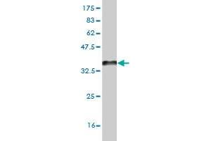 Western Blot detection against Immunogen (33. (ZIC4 anticorps  (AA 249-319))