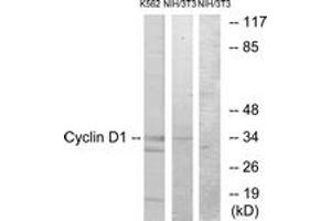 Western blot analysis of extracts from K562/NIH-3T3 cells, using Cyclin D1 (Ab-90) Antibody. (Cyclin D1 anticorps  (AA 56-105))