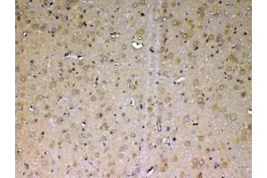 IHC testing of FFPE rat brain tissue with ADA antibody at 1ug/ml. (ADA anticorps  (AA 2-238))