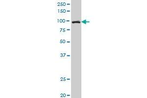 SNX14 polyclonal antibody (A01), Lot # 051003JC01 Western Blot analysis of SNX14 expression in Y-79 . (SNX14 anticorps  (AA 784-893))