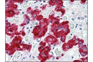 anti-Vesicle-Associated Membrane Protein 2 (Synaptobrevin 2) (VAMP2) (AA 1-89), (N-Term) antibody