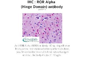 Image no. 1 for anti-RAR-Related Orphan Receptor A (RORA) antibody (ABIN1738922) (RORA anticorps)