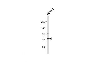 Western Blot at 1:1000 dilution + ZR-75-1 whole cell lysate Lysates/proteins at 20 ug per lane. (CTTNBP2NL anticorps  (N-Term))