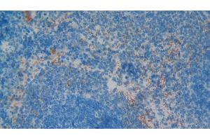 Detection of GP1BB in Rat Spleen Tissue using Polyclonal Antibody to Platelet Glycoprotein Ib Beta Chain (GP1BB)