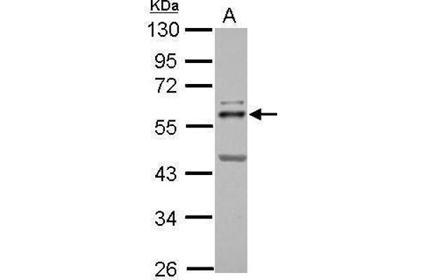 ETS2 antibody  (Center)