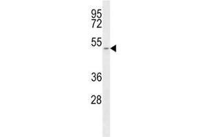 Western blot analysis of SLC16A1/ MCT1 antibody and T47D lysate.