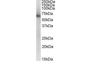 Western Blotting (WB) image for anti-Aldehyde Dehydrogenase 1 Family, Member B1 (ALDH1B1) (AA 363-375) antibody (ABIN490734)