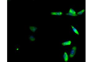 Immunofluorescent analysis of Hela cells using ABIN7142764 at dilution of 1:100 and Alexa Fluor 488-congugated AffiniPure Goat Anti-Rabbit IgG(H+L)