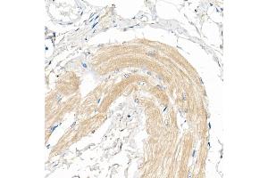 Immunohistochemistry of paraffin-embedded Human skeletal muscle using COX7 Rabbit pAb (4721) at dilution of 1:50 (40x lens).