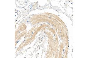 Immunohistochemistry of paraffin-embedded Human skeletal muscle using COX7 Rabbit pAb (4721) at dilution of 1:50 (40x lens). (COX7A1 anticorps  (AA 1-79))