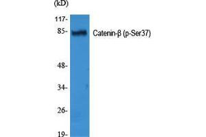 Western Blot (WB) analysis of specific cells using Phospho-Catenin-beta (S37) Polyclonal Antibody. (beta Catenin anticorps  (pSer37))