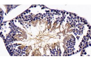 Detection of SIRT5 in Mouse Testis Tissue using Polyclonal Antibody to Sirtuin 5 (SIRT5)